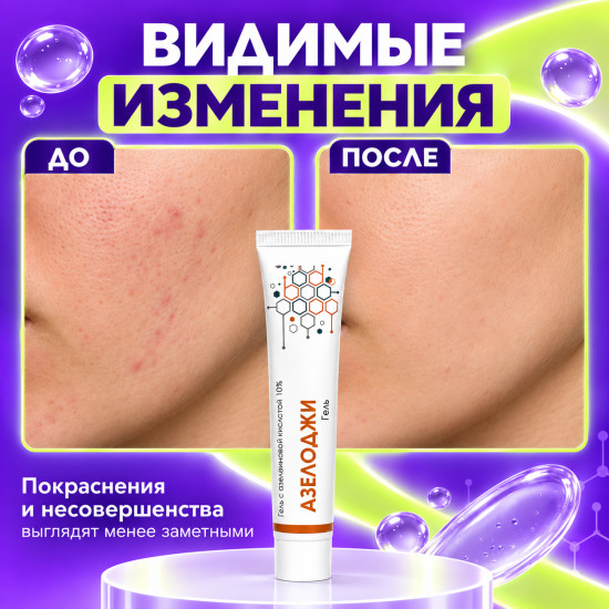 Гель от акне и прыщей с азелаиновой кислотой 10% для лица Азелоджи, 30 г