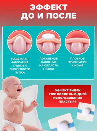 Детский пластырь-бандаж от пупочной грыжи фиксатор на брюшной отдел размер универсальный белый, голубой