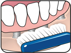 Щетка зубная TePe Implant Orthodontic - Фото 4