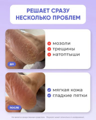 Крем для ног с мочевиной от трещин и натоптышей - Фото 3