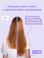 Спрей для роста и против выпадения волос «Magic spray» - Фото 3