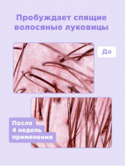 Спрей для роста и против выпадения волос «Magic spray» - Фото 4