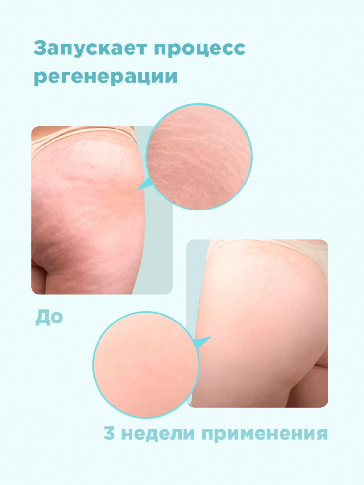 Молочко-эликсир для тела «Soft skin» | Soft skin | Likato Professional | Фото 2