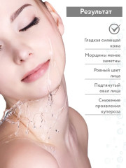 Набор для карбокситерапии для сухой и зрелой кожи «Anti-Age Set» - Фото 4