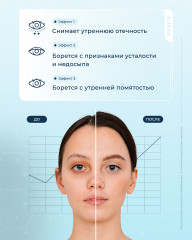 Сыворотка для кожи вокруг глаз питательная с витамином С 7% - Фото 2