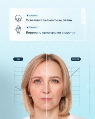 Сыворотка для кожи вокруг глаз питательная с витамином С 7% - Фото 4