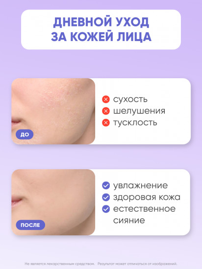 Крем для лица интенсивно увлажняющий с мочевиной 10%