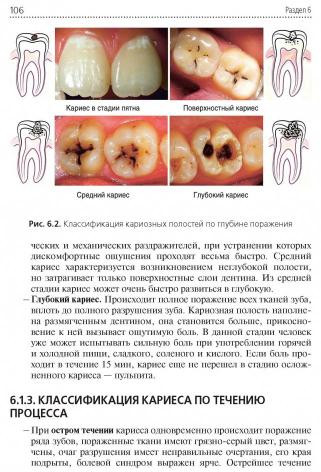 Стоматологические заболевания