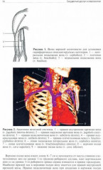 Сосудистый доступ в гематологии - Фото 1