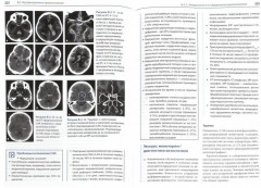 Неотложная неврология - Фото 1