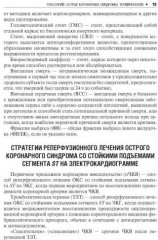 Острый коронарный синдром. Руководство - Фото 3