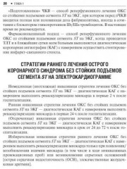Острый коронарный синдром. Руководство - Фото 4