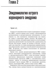 Острый коронарный синдром. Руководство - Фото 5