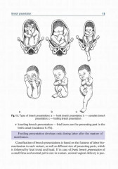 Obstetrics and gynecology. Textbook in 4 Vol. Vol. 2. Obstetric pathology - Фото 3