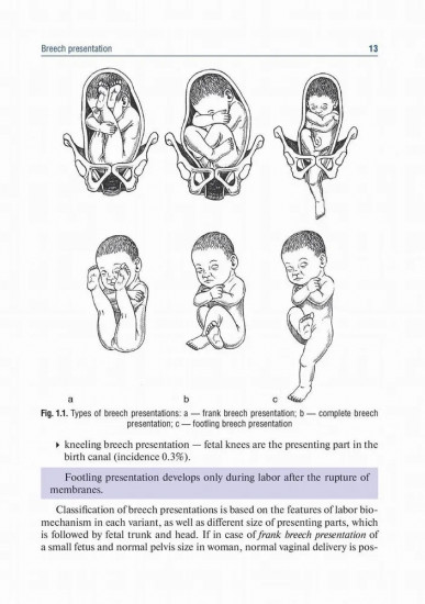 Obstetrics and gynecology. Textbook in 4 Vol