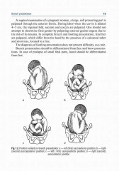 Obstetrics and gynecology. Textbook in 4 Vol. Vol. 2. Obstetric pathology - Фото 5