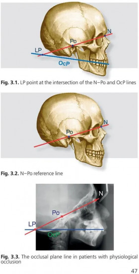 Orthodontics. Modern Methods