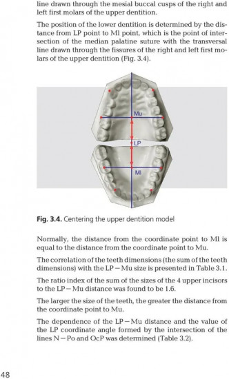 Orthodontics. Modern Methods