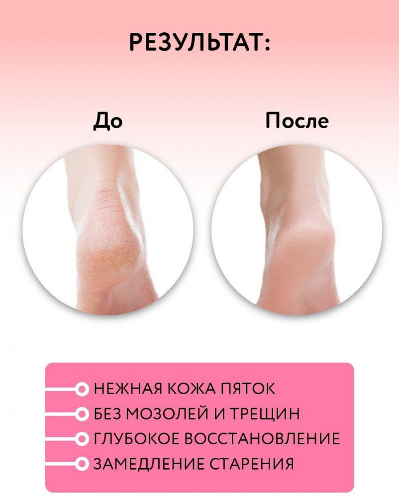 Крем для ног с мочевиной — Mirrolla