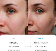 Сыворотка-концентрат многофункциональная 5 в 1 - Фото 4