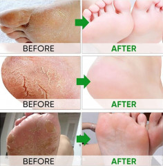 Пилинг-носочки с экстрактом мяты - Фото 2