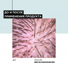 Гель для чувствительной кожи головы - Фото 5