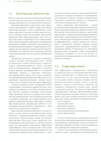 Протезирование с опорой на имплантаты