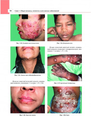 Дерматология в общеврачебной практике. Практическое руководство - Фото 1