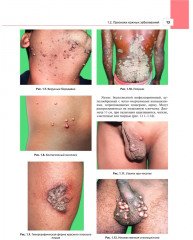 Дерматология в общеврачебной практике. Практическое руководство - Фото 2