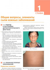 Дерматология в общеврачебной практике. Практическое руководство - Фото 4