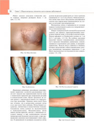 Дерматология в общеврачебной практике. Практическое руководство - Фото 5