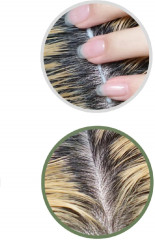 Набор сывороток-пилинг для кожи головы - Фото 5