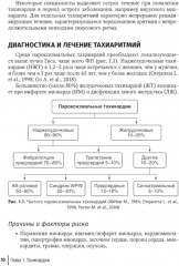 Аритмии сердца. Руководство - Фото 1