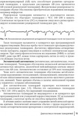 Аритмии сердца. Руководство - Фото 4