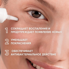 Крем для лица точечный от воспалений «SOS Treatment Anti-Blemish Gel» - Фото 4