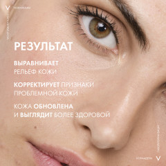 Normaderm Probio-BHA Serum Пробиотическая обновляющая сыворотка против несовершенств кожи - Фото 10