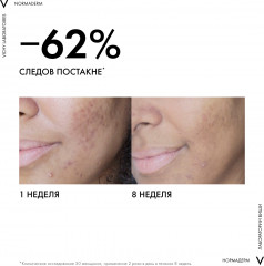 Уход для лица корректирующий дневной двойного действия «Normaderm Phytosolution» - Фото 15