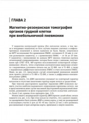 МРТ в диагностике воспалительных заболеваний легких вирусной этиологии и их осложнений - Фото 1