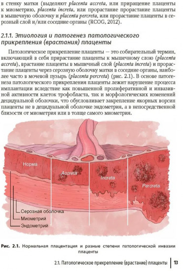 Кровотечения в акушерской практике