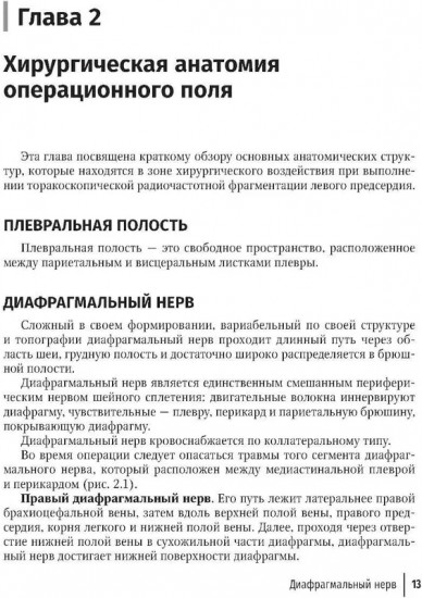Торакоскопическая радиочастотная фрагментация левого предсердия