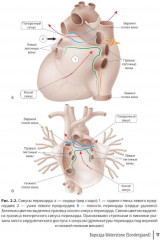 Торакоскопическая радиочастотная фрагментация левого предсердия - Фото 7