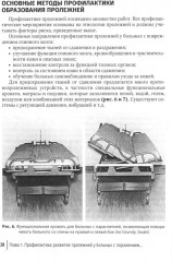 Профилактика и хирургическое лечение пролежней - Фото 6