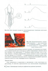 Профилактика и хирургическое лечение пролежней - Фото 8