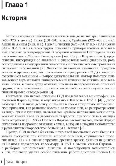 Системная склеродермия