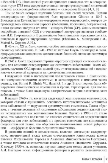 Системная склеродермия