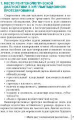 Рентгенологическая оценка качества имплантационного протезирования - Фото 1