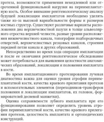 Рентгенологическая оценка качества имплантационного протезирования - Фото 2