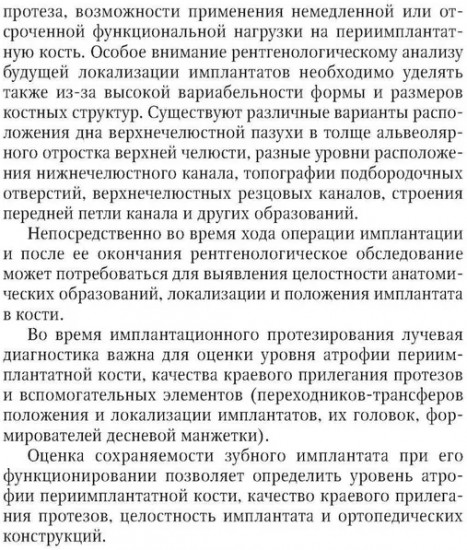 Рентгенологическая оценка качества имплантационного протезирования