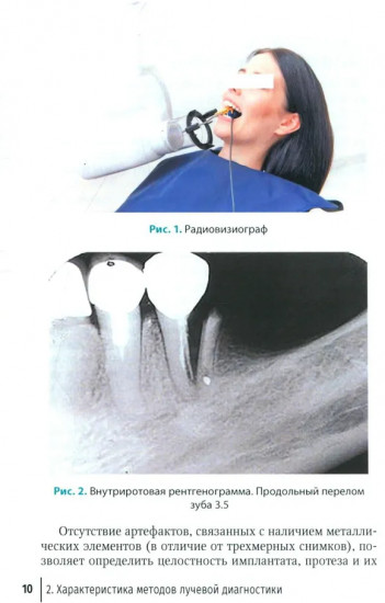 Рентгенологическая оценка качества имплантационного протезирования