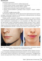 Применение компьютерных технологий для оценки состояния зубочелюстной системы - Фото 4